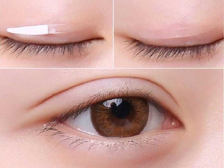 Cách Tạo Mắt 2 Mí Không Cần Phẫu Thuật Các Chị Em Nên Biết
