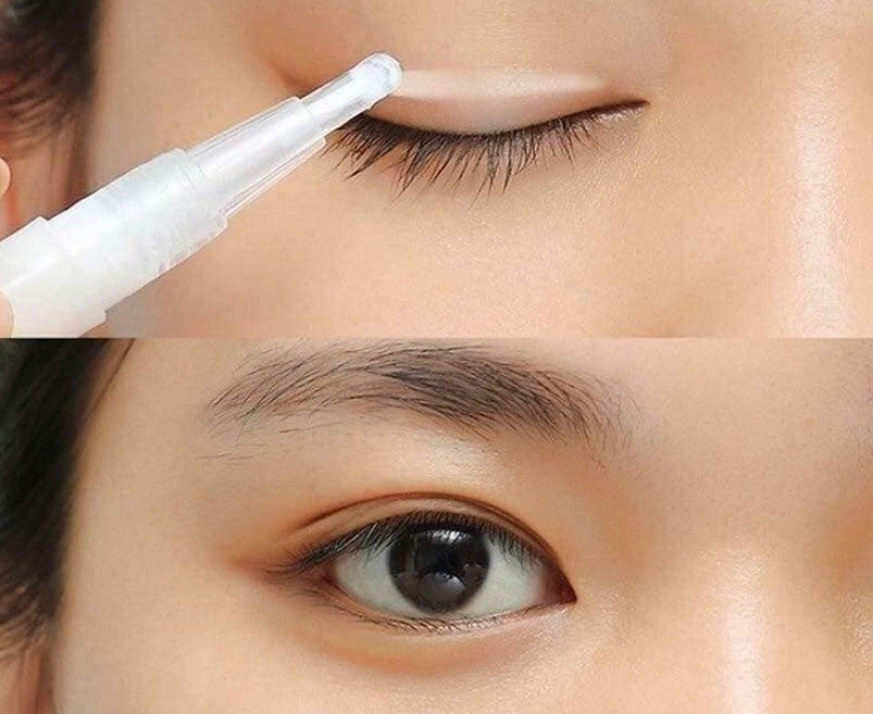 Keo kích mí khá tiện lợi, dễ sử dụng