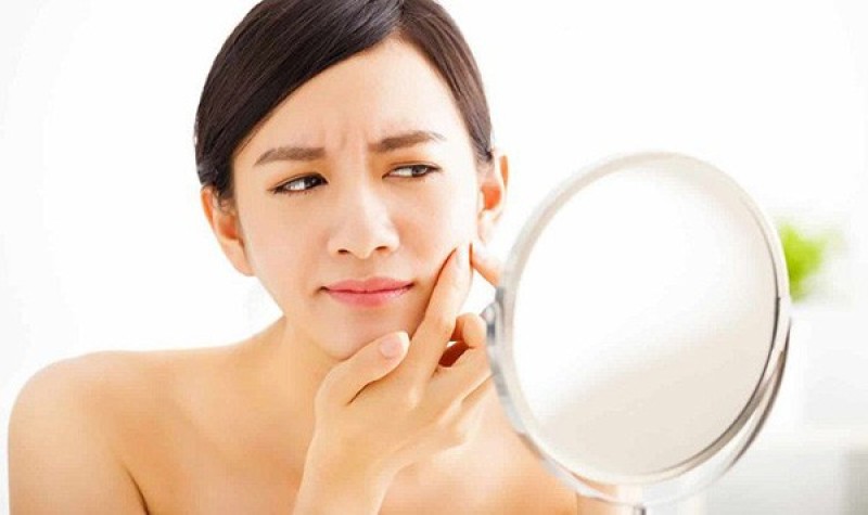 Nếu tình trạng mụn của bạn nhẹ thì có thể xử lý tại nhà.