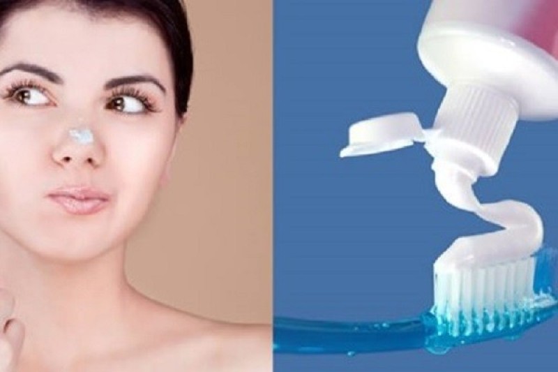 Kem đánh răng có công dụng tốt trong việc trị mụn đầu đen.