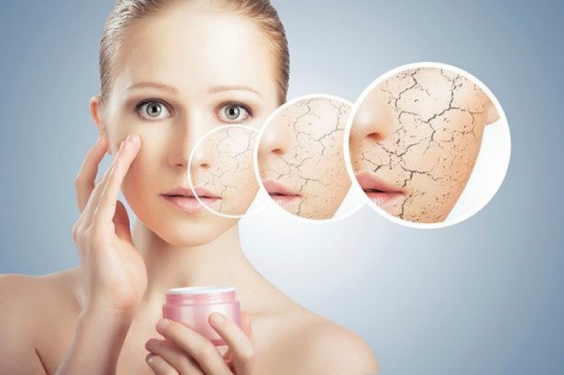 Da nứt nẻ là nỗi lo sợ của nhiều cô gái vào mùa đông.