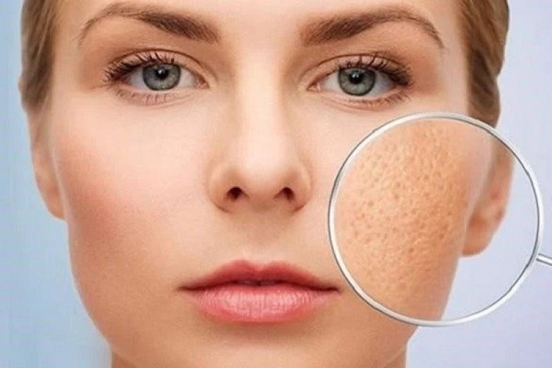 Bạn đã biết cách se khít lỗ chân lông mặt tại nhà chưa?