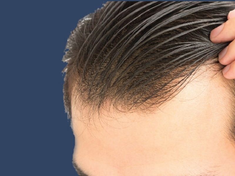 10 Cách Làm Phồng Tóc Nam Cực Hiệu Quả
