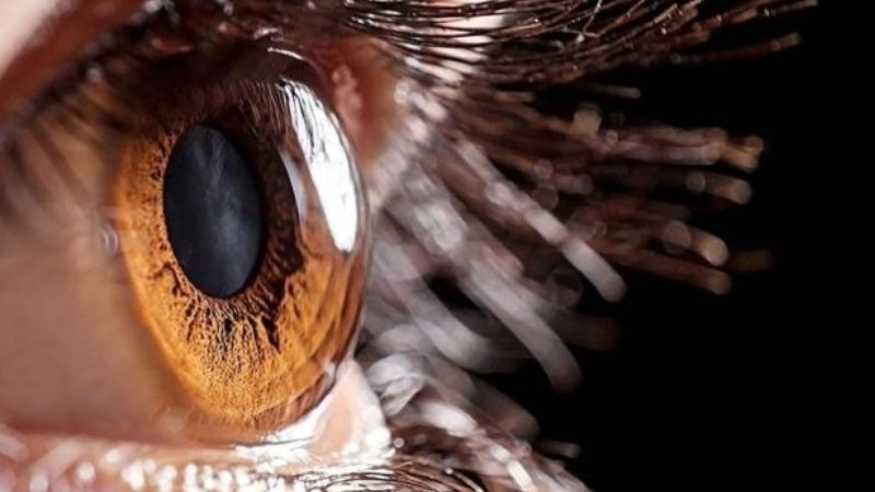 Thay đổi độ cong giác mạc