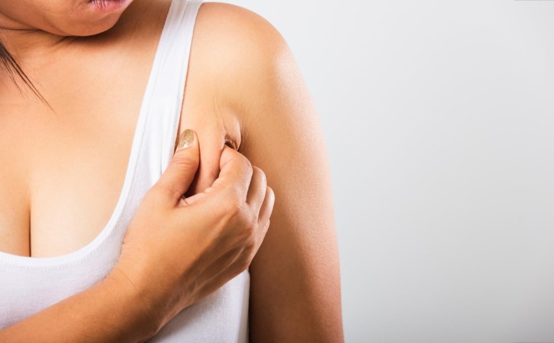 Mỡ Nách Do Đâu? 10+ Cách Giảm Mỡ Nách Cấp Tốc An Toàn Hiệu Quả