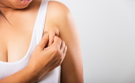 Mỡ Nách Do Đâu? 10+ Cách Giảm Mỡ Nách Cấp Tốc An Toàn Hiệu Quả